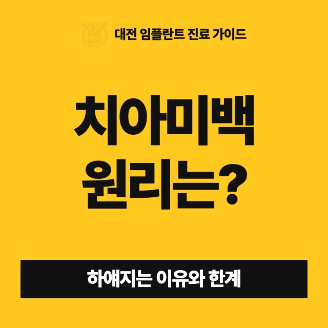치아미백을 하면 정말 하얘지나요, 어떤 원리인가요?
